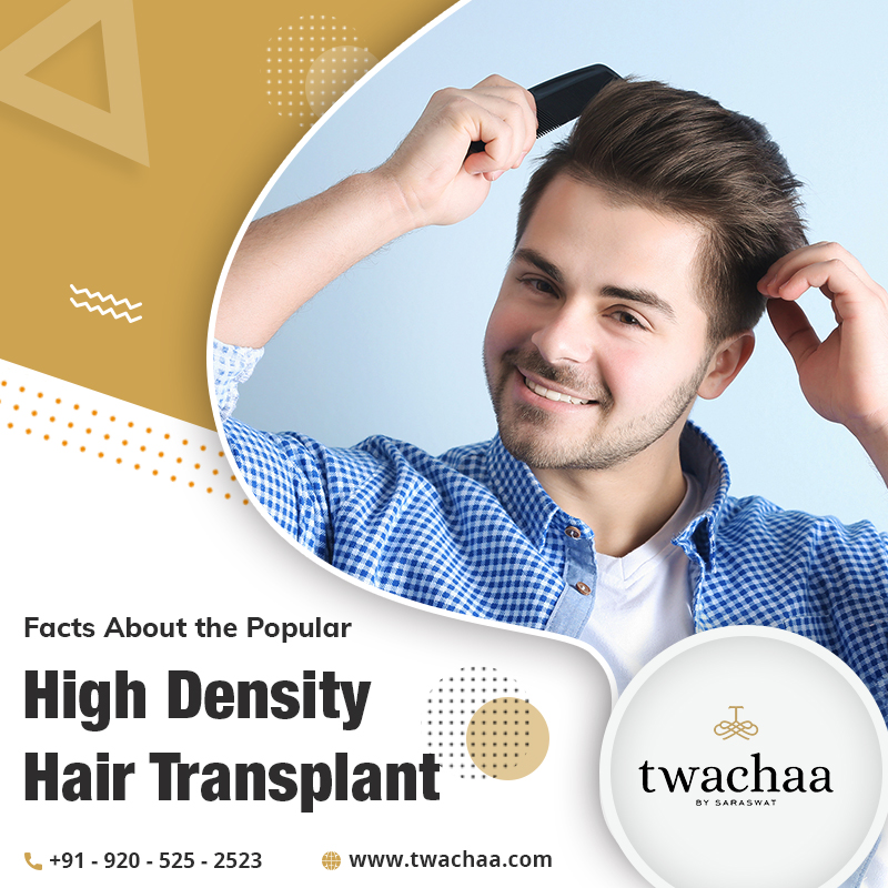 What is High Density Hair Transplant and Why is it so Popular?