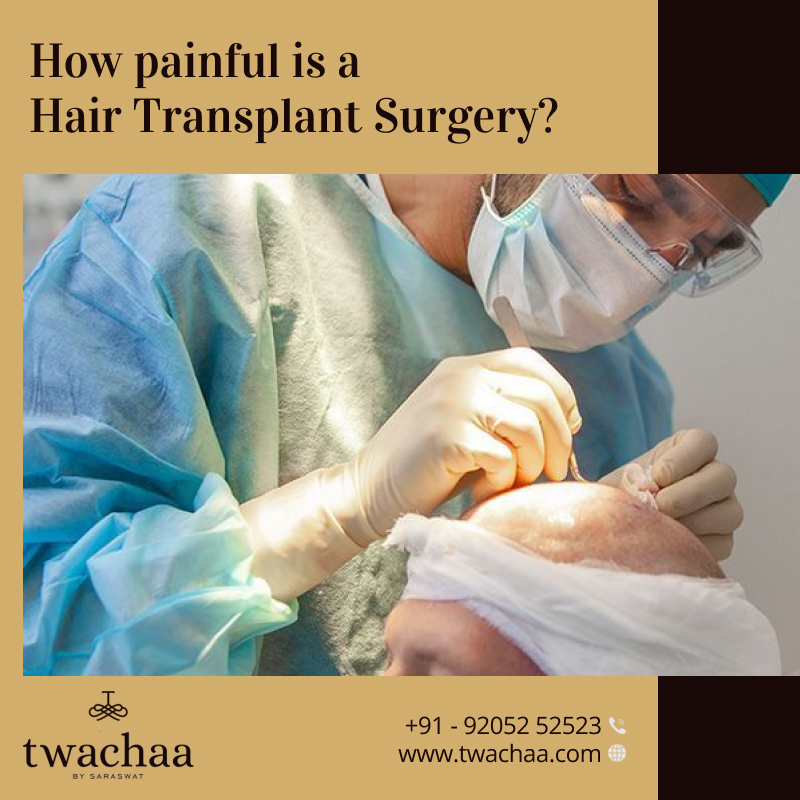 Is Hair Transplant Painful?