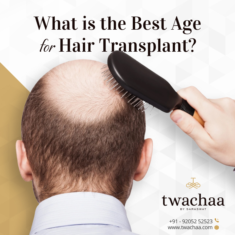 Which Age is the Best for Hair Transplant?