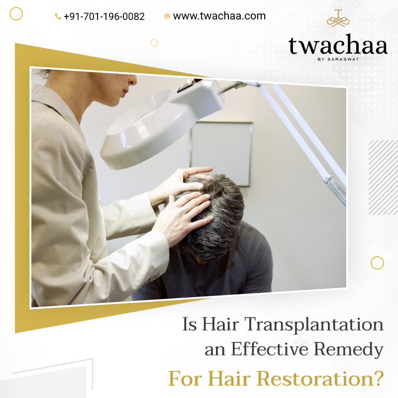 What is Hair Transplantation? Is it an Effective Remedy?
