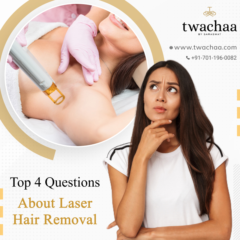 What Are The Most Common Doubts About Laser Hair Removal?