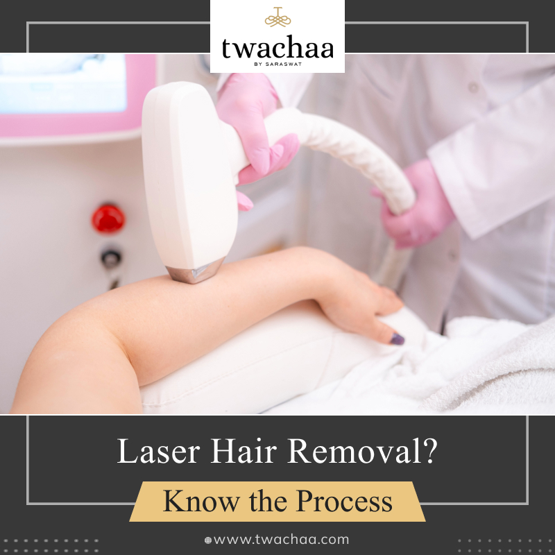What Are The Steps to Conduct a Laser Hair Removal Procedure?