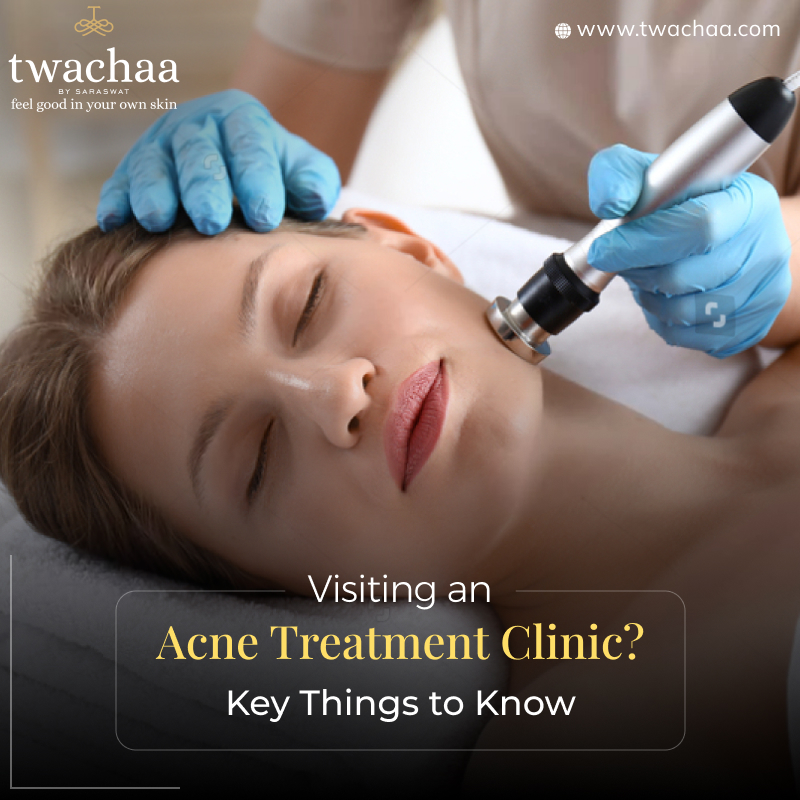 Important Things to Note Before You Visit an Acne Treatment Clinic