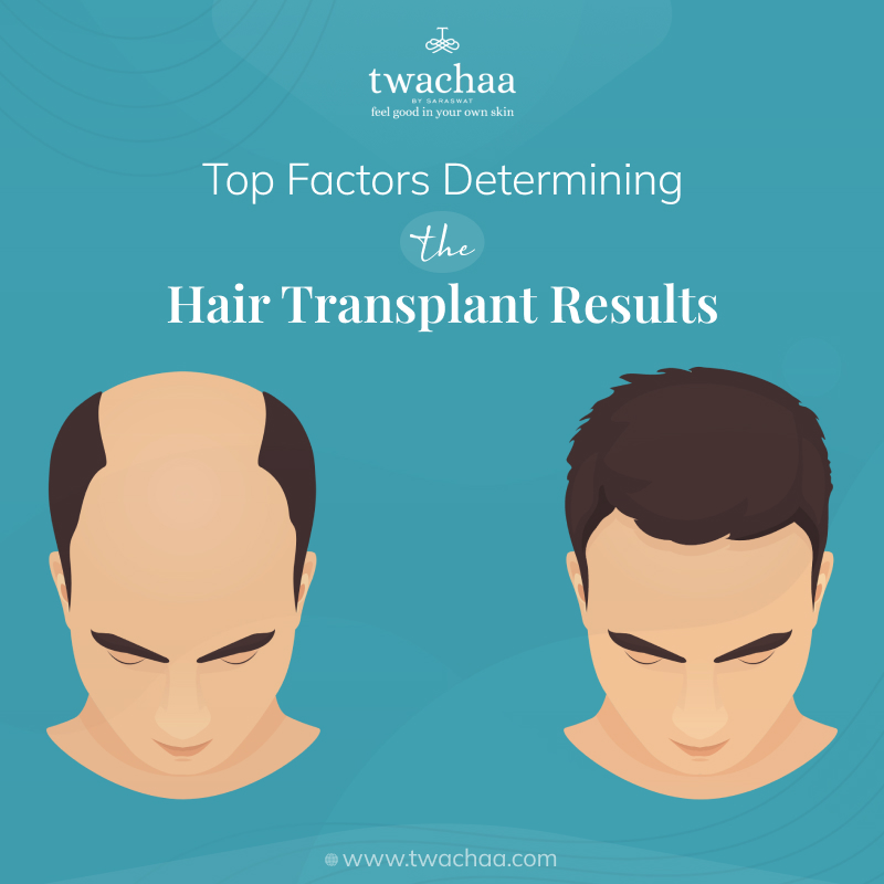 Top 7 Determining Factors for Successful Hair Transplants